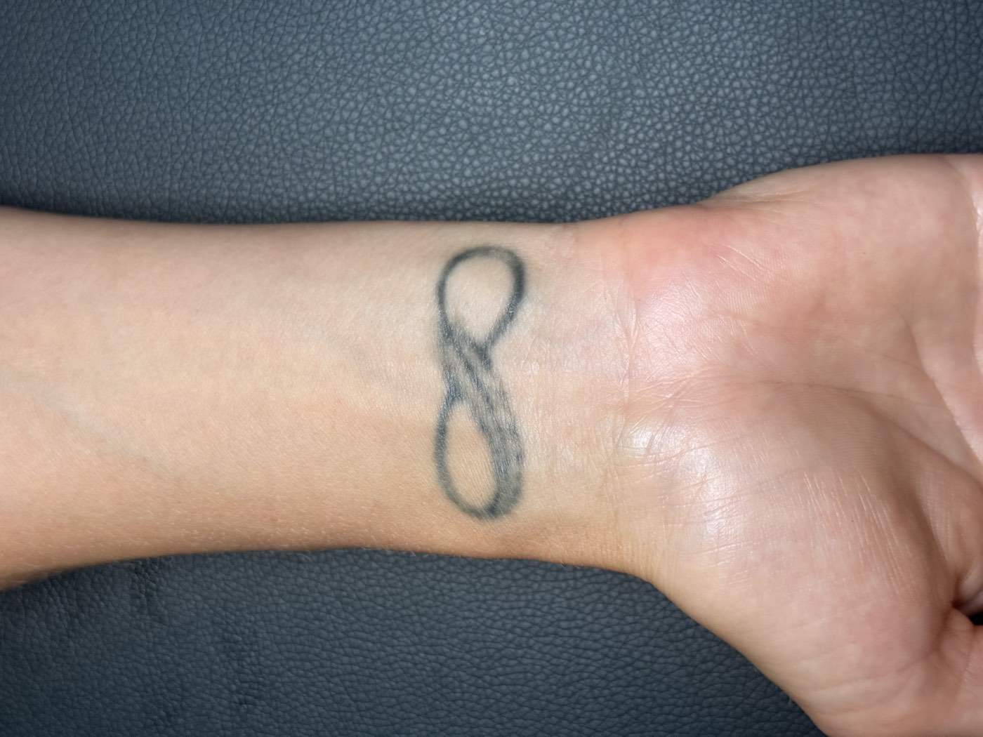 Wrist infinity tattoo after treatment