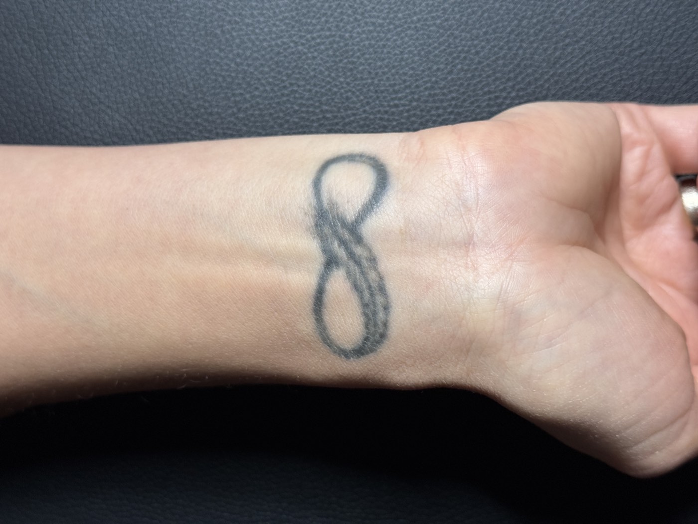Wrist infinity tattoo before treatment