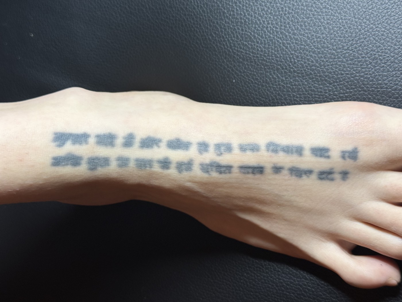 Foot script tattoo before treatment