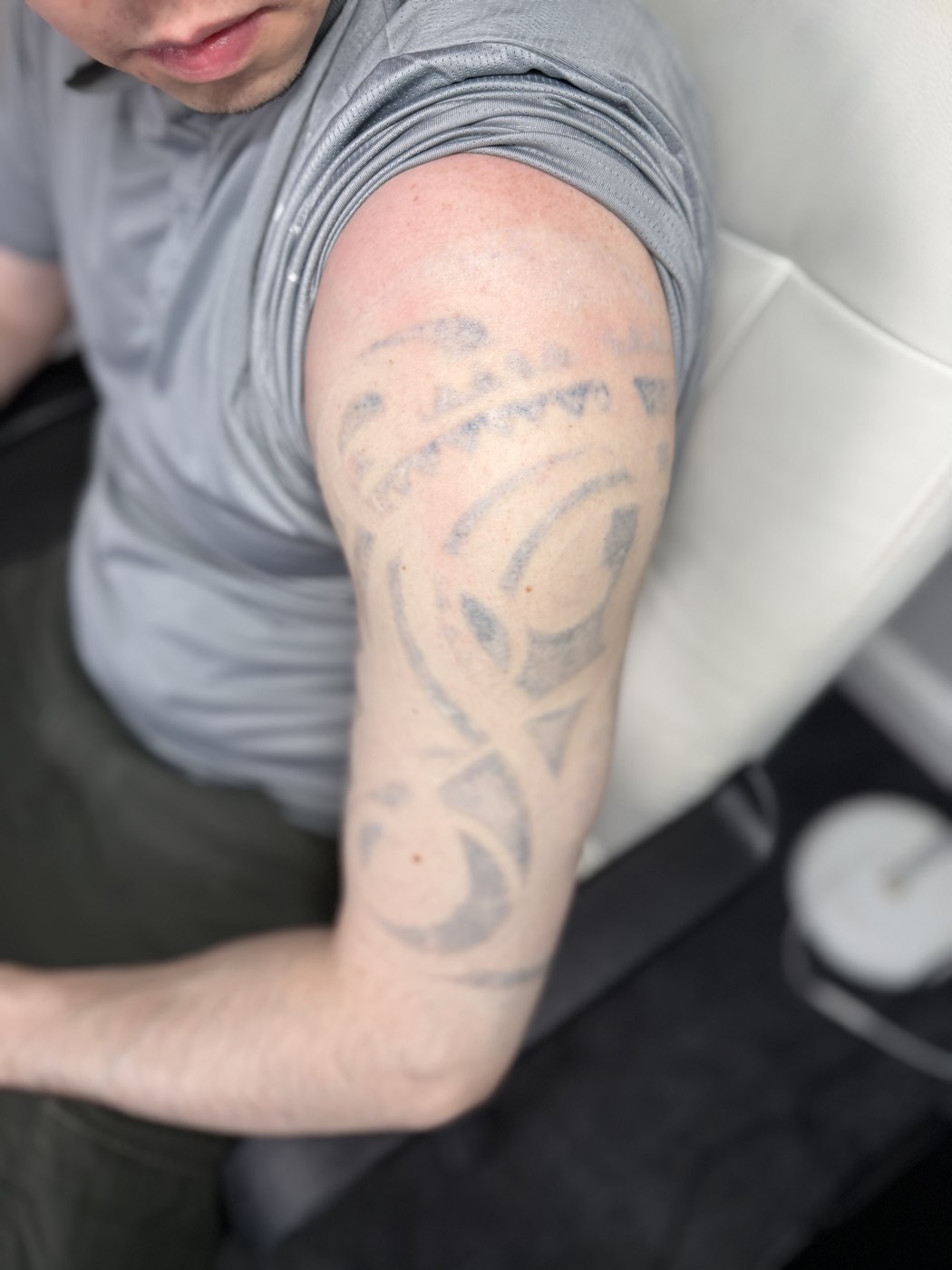 Tribal tattoo after treatment
