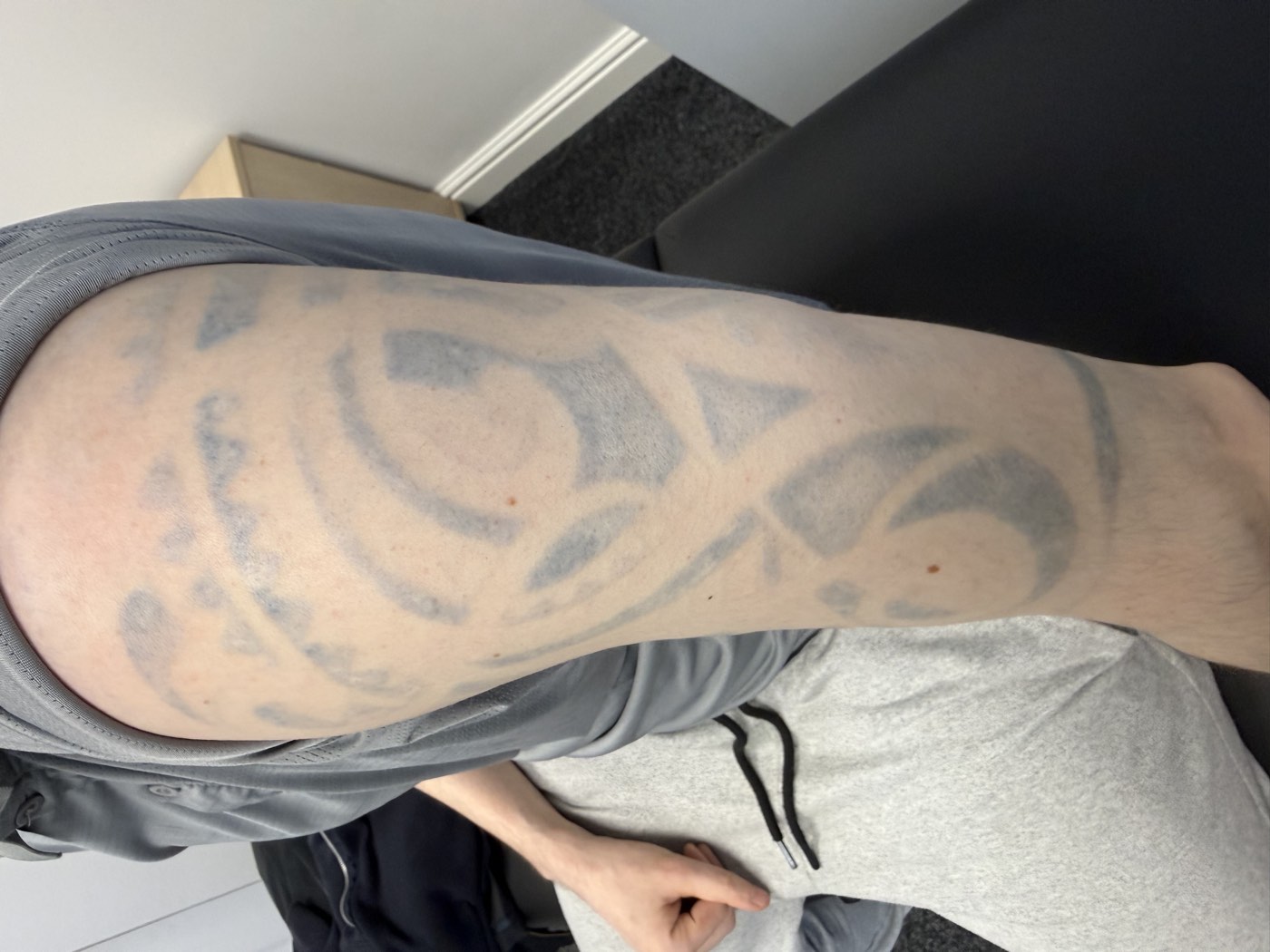 Tribal tattoo before treatment